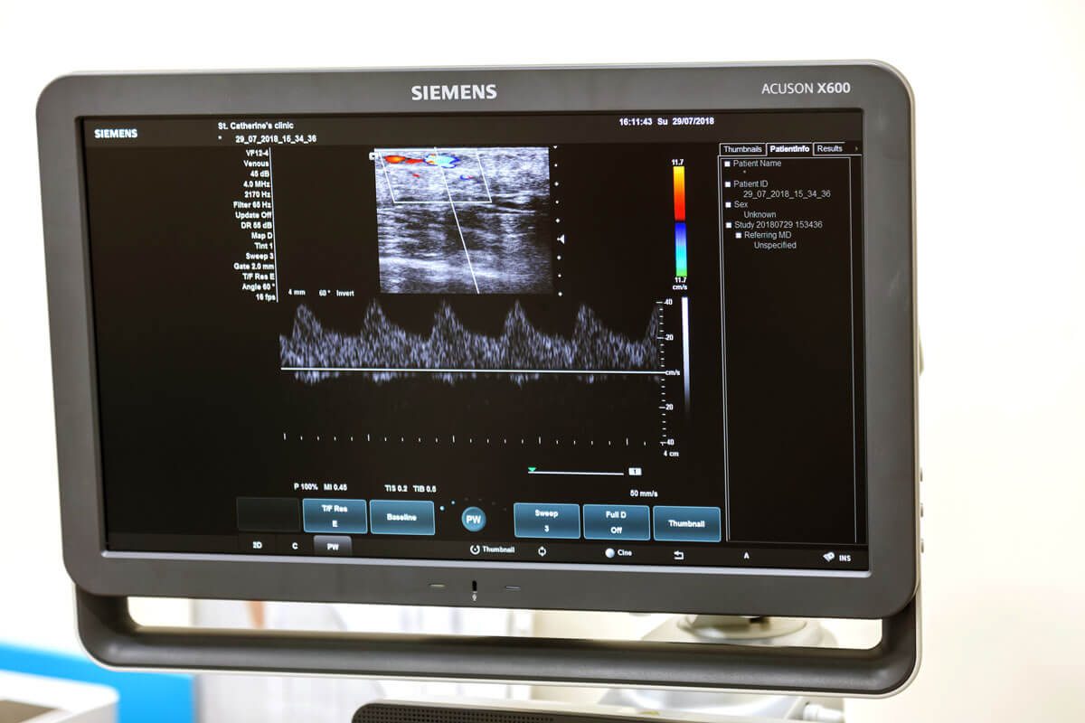 Ecocolordoppler Simens